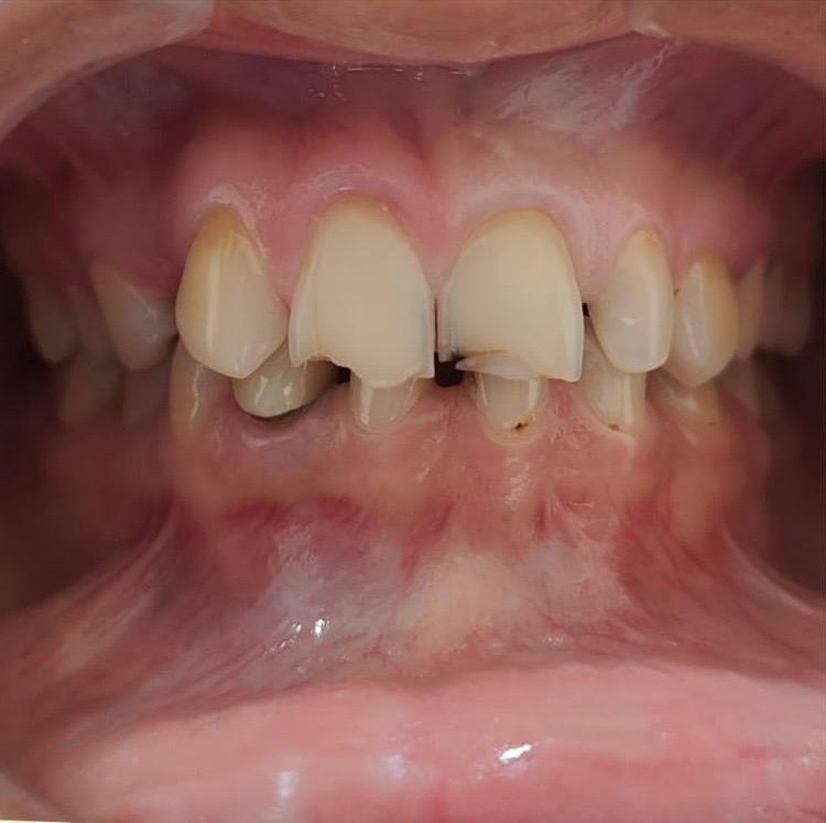 Dental Treatment Before