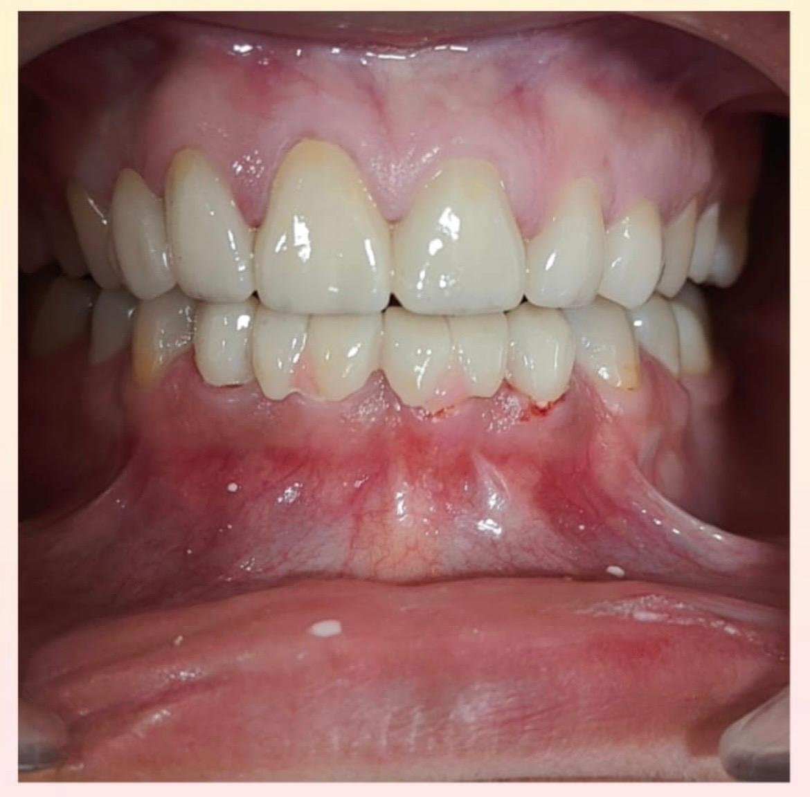 Dental Treatment After