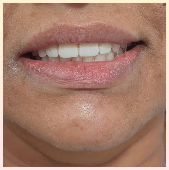 Dental Treatment After