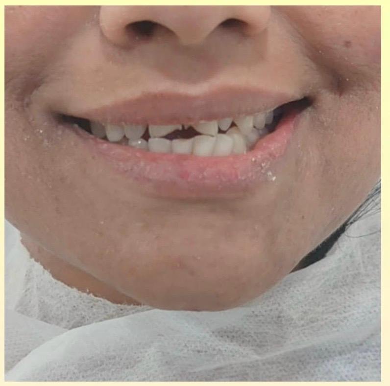 Dental Treatment Before