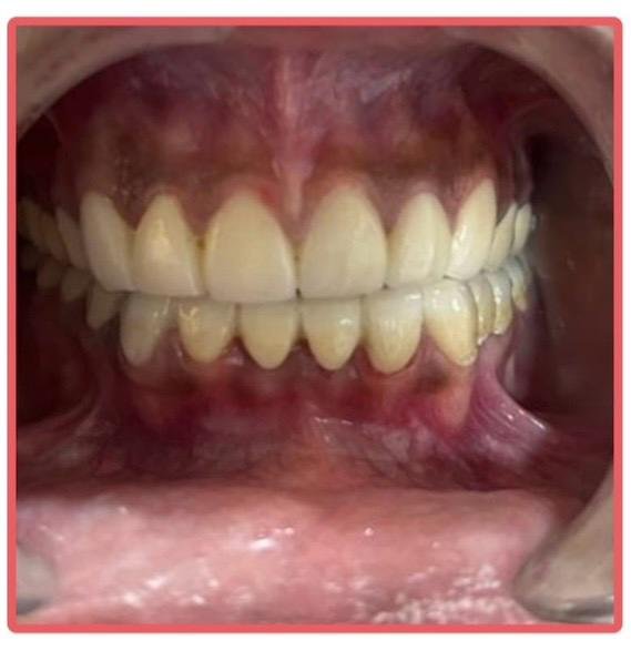Dental Treatment After